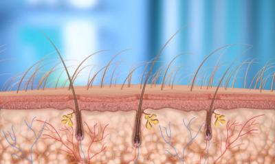 Laser Removal Of Hair:An Overview