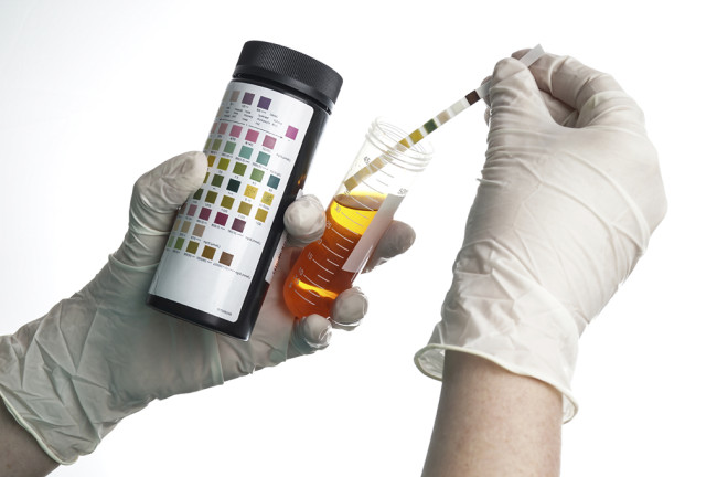 How To Beat Urine Tests This New Year?