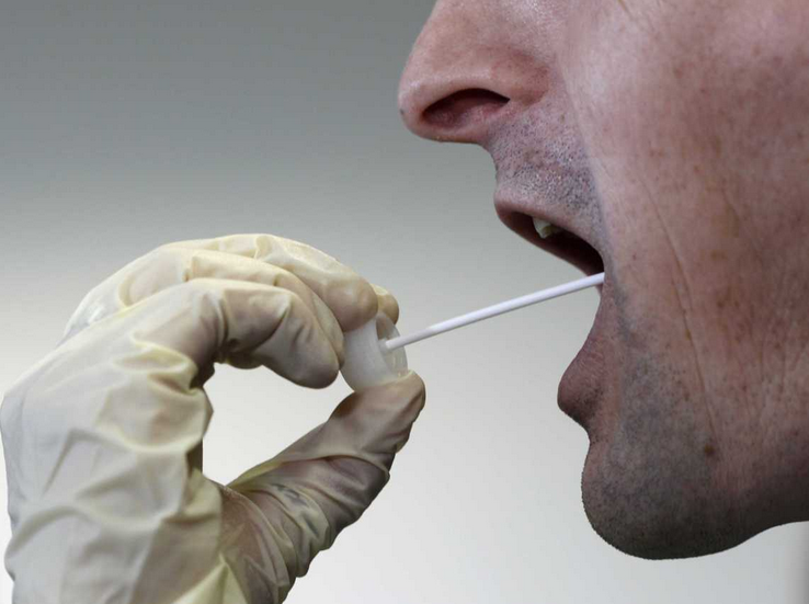 Some Frequently Asked Questions About Saliva Drug Testing Kits