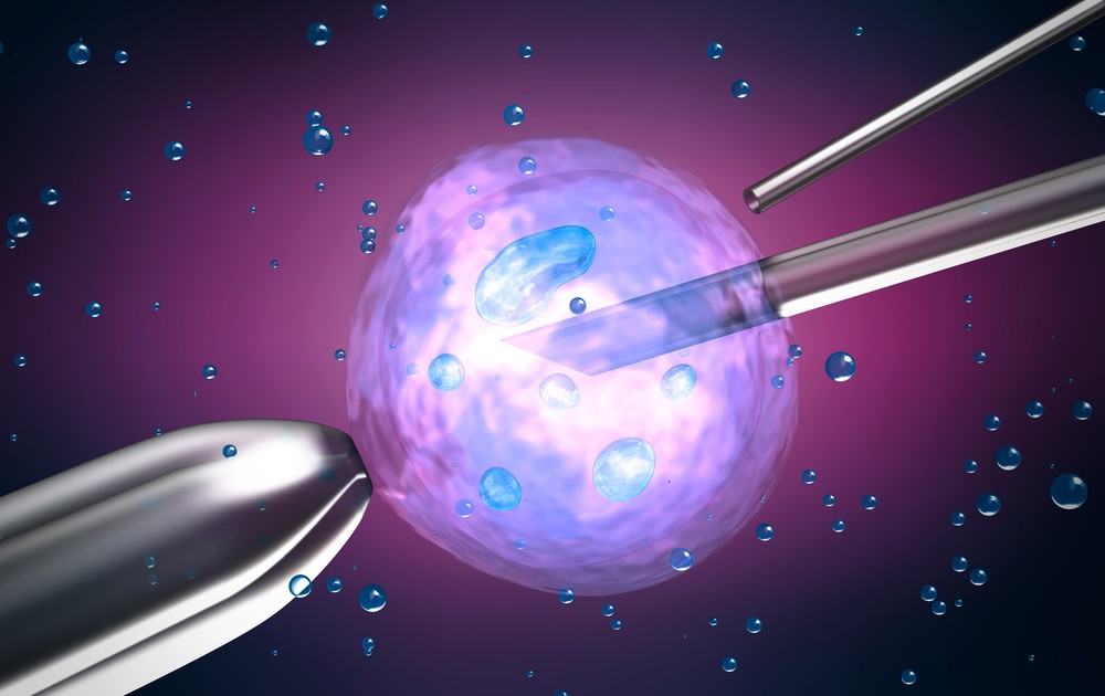 What Is In Vitro Fertilization and Why Is There A Need For It?