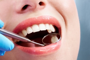 Here’s What You Need To Ask Your Dentist