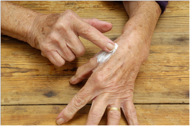 Top 5 Medicinal Creams To Ease The Arthritis Pain
