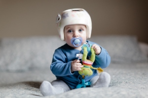 Infant Plastic Surgery and Positional Plagiocephaly With The Help Of Alton Ingram MD